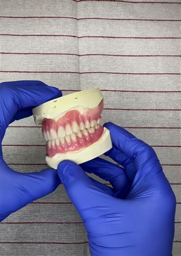 Beautifully Crafted Complete Dentures for a Confident Smile!! 😁