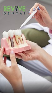 Once healed, dental implants function just like natural teeth—no slipping, no clicking, no worrying about adhesives. Whether you need a single tooth replaced or a full‑arch All‑on‑6 restoration, they’re designed to look, feel, and perform like the real thing so you can eat, smile, and live confidently again. Curious if implants are right for you? Revive‑Dental™ is here for Boulder, Longmont, Firestone, and nearby communities. 📞 303‑226‑0420 | www.revive-dental.com #AllOn6Boulder #LongmontDental