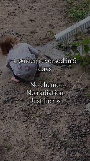 10K views · 4K reactions | Over 100 types of cancer reversed in 5...
