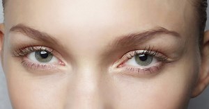 La blépharoplastie, l'opération pour en finir avec les poches sous les yeux