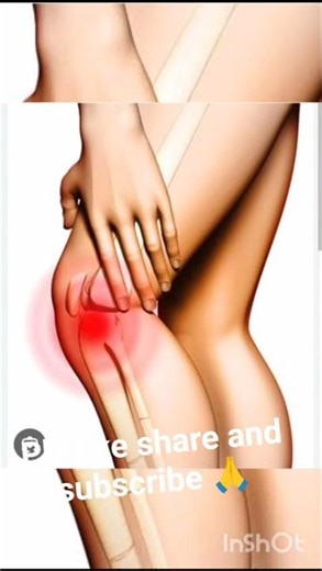 knee joint xray#kneepain#kneepainrelief#xrayknee#operationalexcellence#kneejoint#xray#technician