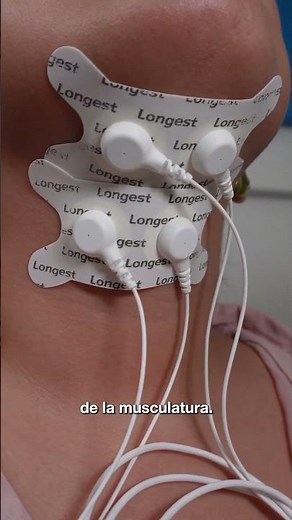 ¿Cómo funciona el equipo SD Stim Pro para el tratamiento de la disfagia?