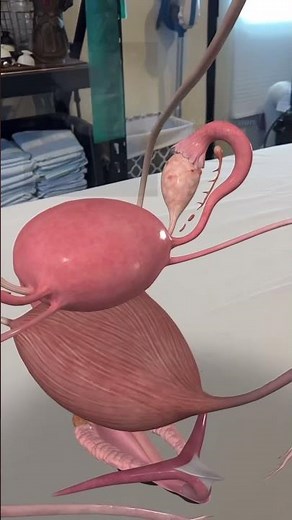 Hyper-ovulation: When both ovaries release eggs at once #womenshealth