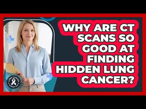 Why Are CT Scans So Good At Finding Hidden Lung Cancer? - Lung Cancer Support Hub