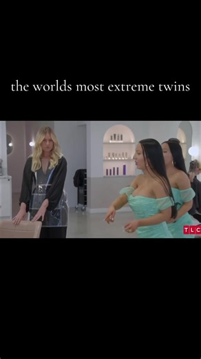 the worlds most extreme twins: anna and lucy #annaandlucy #extremetwins #fyp #tiktok