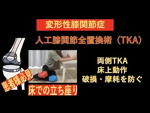 見て納得 人工膝関節全置換術（TKA）の日常生活動作（ADL）指導-破損や摩耗を防ぐ、両側TKAにおける床の上での立ち座りの方法-