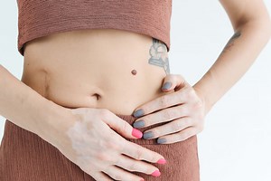 Scars | Brisbane Skin, Dermatologist Brisbane. Medical, surgical, cosmetic