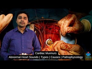 Cardiac Murmurs (Abnormal Heart Sounds) | Types | Causes | Pathophysiology | Dr Krunal Dabhi