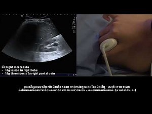 Liver Ultrasound Practice demonstration