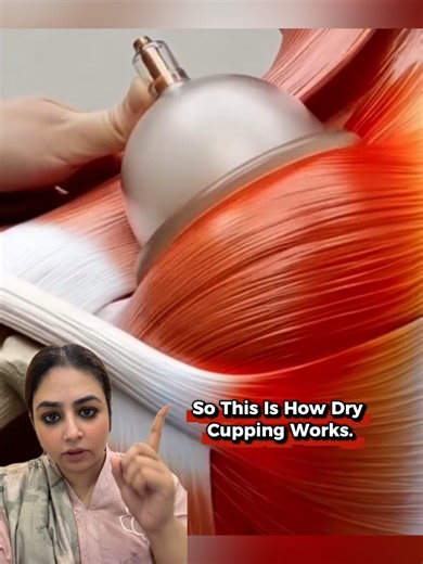 Many people ask: How does dry cupping work? 🤔 Dry cupping targets deep muscle layers to improve blood circulation, support lymphatic drainage, and help the body detox naturally. It relaxes tight muscles, releases tension, improves mobility, and increases range of motion—especially in areas like the neck and shoulders. A powerful therapy for pain relief, muscle stiffness, and overall muscle recovery. 💆‍♂️✨ 📞 Book your session now: 0337-1707011 | 0300-1707011 #DryCupping #CuppingTherapy #PainRe