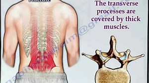 Lumbar Spine Transverse Process Fracture - Everything You Need To Know - Dr. Nabil Ebraheim