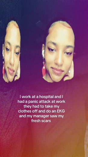 Managing Panic Attacks at Work: A Personal Journey