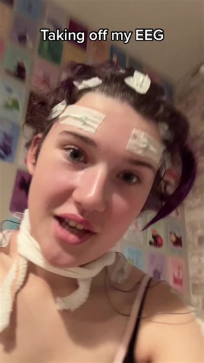 Understanding EEG Scans for Hidden Disabilities