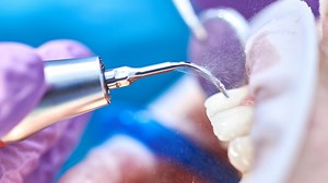 Dental Hygeine - Practice Tests For NBDHE & NDHCB Exams