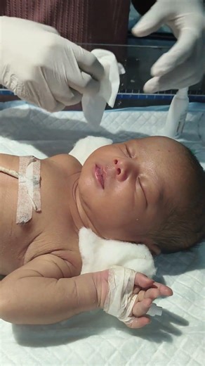 just born baby being face clean in morning hour 🥰👉#youtubeshorts #babychoice #neonatologist