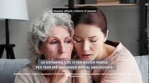 359K views · 3.1K reactions | The Improving Detection of AL Amyloidosis (IDEA) QuickFire Challenge invites innovators to submit products, technologies, or methodologies for optimizing detection & early diagnosis. | Johnson & Johnson | Facebook