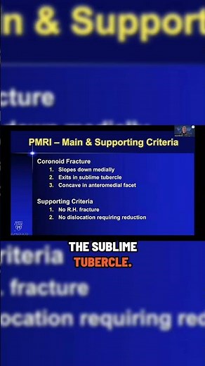 What is PMRI - posteromedial rotatory instability