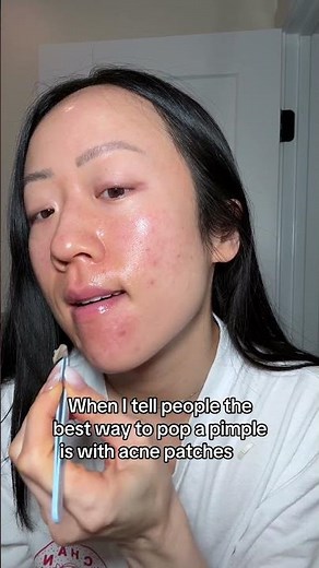 🫢 The trick is to use an acne patch with exfoliating ingredients (like salicylic acid or retinol)