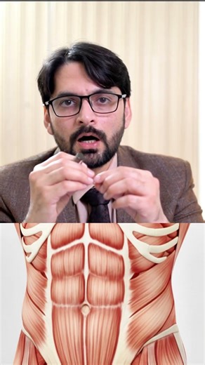 3 Small Holes vs. One Big Cut: Why Laparoscopic Appendix Surgery is Better!