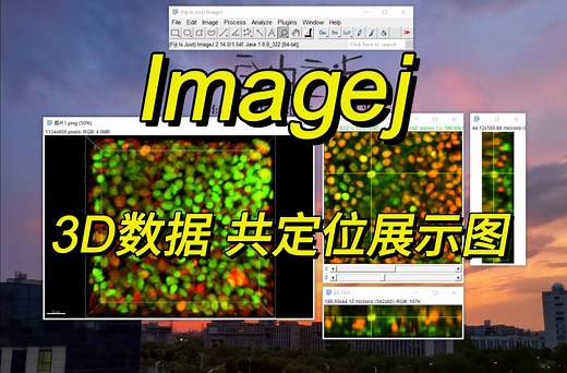 Imagej：3D数据 共定位展示图