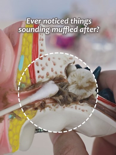 Ultimate Ear Cleaning ASMR Tools Revealed