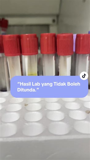 Kalau gula darah terlalu tinggi, ginjal akan “menyerah” dan gula keluar lewat urin. Angka setinggi ini bukan diabetes biasa. Ini kondisi gawat yang harus segera ditangani #laboratorium #lab #diabetes #edukasikesehatan #fyp