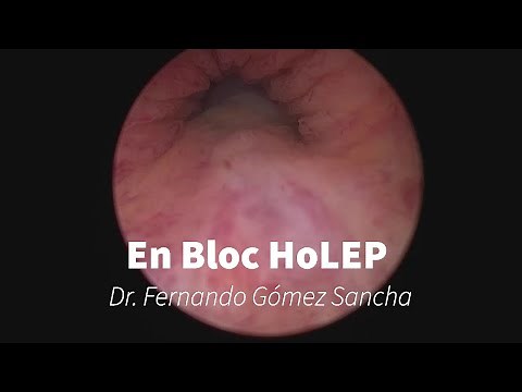 En Bloc HoLEP with early apical liberation