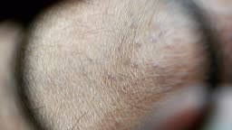 Close up of Human Skin Texture