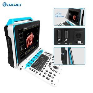 [Hot Item] 3D 4D Portable Color Doppler Ultrasound with High Image Quality for Hospital