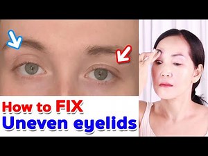 How to Fix Uneven eyelids, Lift Droopy & Hooded eyelids naturally | NO TALKING | Anti aging