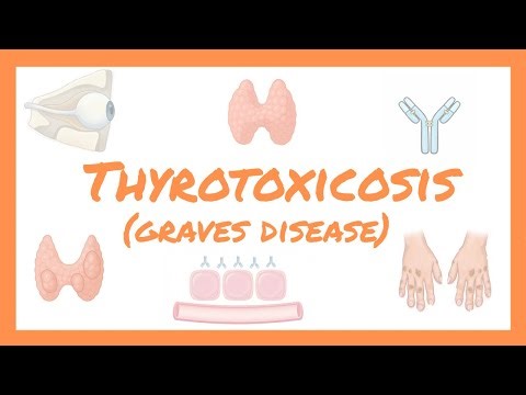 Thyrotoxicosis – Graves disease | شرح بالعربي