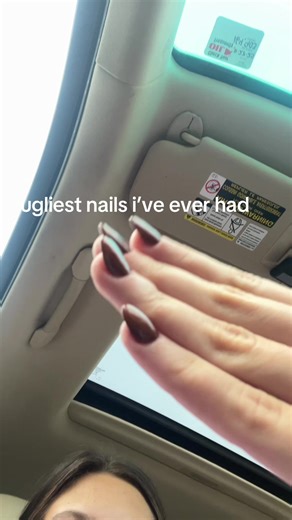 Nail Art Disaster: My Ugliest Nails Experience