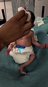 Morning Baby Care Routine | Gentle Sponging & Cleaning for Newborn" ✨ #fblifestyle #MorningBabyCare #BabyCleaning #BabySponging #NewbornCare #BabyRoutine #GentleCare #HealthyBaby #BabyHygiene #CuteBabyCare #BabyMorningRoutine #BabyDailyCare #BabyLove #BabyWellness #SoftSkinCare #BabyBathTime | Little Angel Care