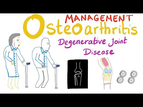 Osteoarthritis (OA) - Treatment - Degenerative Joint Disease - Rheumatology Series