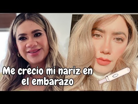 Mi nariz crecio en el embarazo
