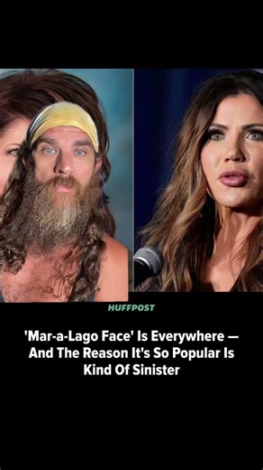 Mar-a-Lago face #MaraLago #ChelseaHandler #HuffPost #Comedy #Comedian #TadpoleTriplett