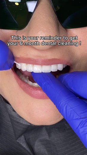 Importance of Dental Cleaning Every 6 Months