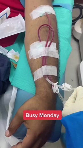 Busy Monday #hemodialysis #kidneyfailure #kidneydoctor #doctor #fyp