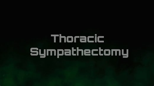 Understanding Thoracic Sympathectomy