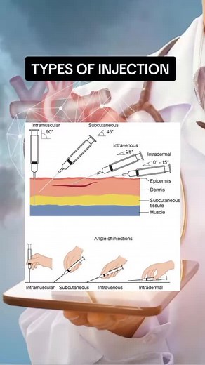 Nice visual on type of injections and each angle from @_tirimude_ #nursingstudent #studentnurses #injections #nursingskills #nursingeducation