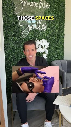 How your face changes with braces