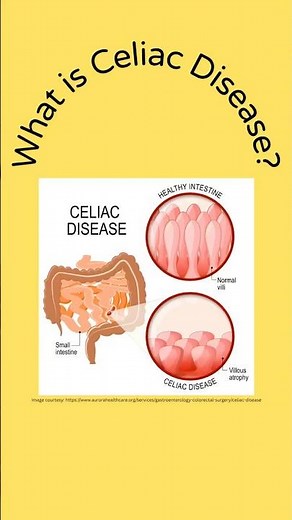 What Is Celiac Disease?- More than just an allergy.