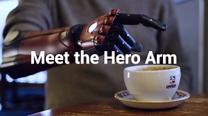 ⭐️ Meet the new Hero Arm! 🦾 The world’s most affordable multi-grip bionic arm just received an upgrade: robust laser-sintered frames, innovative socket technology, new magnetic covers... and so much more. 🦸 Your limb difference is your superpower. ✅ View pricing and availability here! | Open Bionics