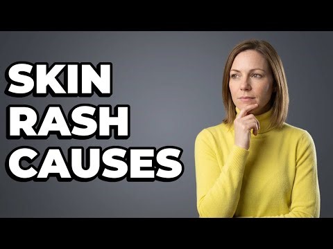 What Causes A Nickel Skin Allergy?