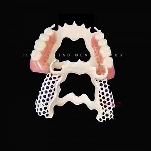 [Hot Item] Comfortable Dental Composite Bio-Peek Material Partial Removable Dentures
