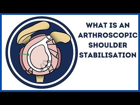 What is an Anterior Shoulder Stabilisation?