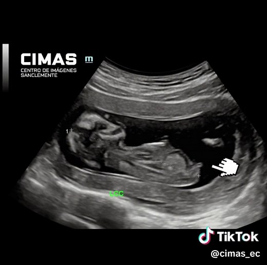 CIMAS - Centro de Imágenes. on TikTok