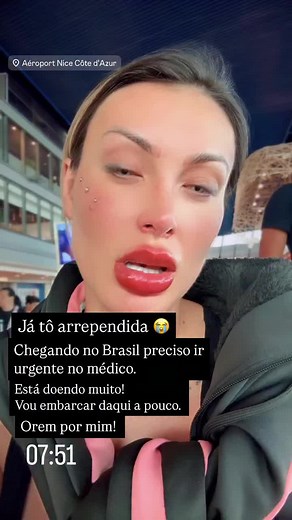 Andressa Urach e suas complicações nos olhos