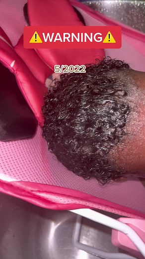 The best cradle cap removal. You can safely get rid of your baby’s cradle cap with our baby oil and grow your babies hair simultaneously with the butter ! #naturalhaircare #blackhairtiktok #blackgirlhair #naturalhair #naturalhairstyles #hairtok #cradlecapremedy #cradlecapremover #cradlecapremoval #cradlecaprelief #cradlecap #cradlecaphack #cradlecapdoctor #cradlecaptreatment