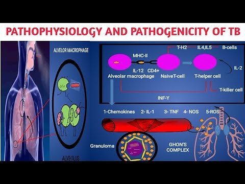 Pathophysiology/ pathogenicity of Mycobacterium tuberculosis II Primary and secondary TB (Part-2)